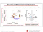 RPS15 mutations rewire RNA translation in chronic lymphocytic leukemia